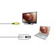 Vidéotoscope MD Scope - Pack Deluxe - 4 Sondes